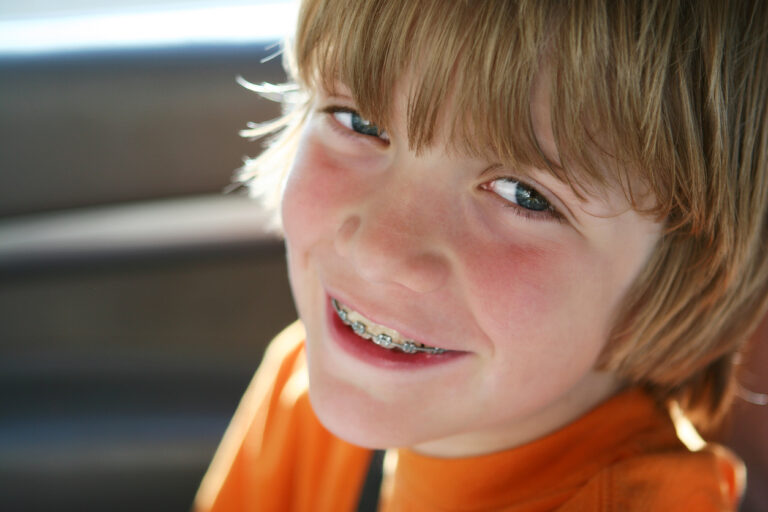 Close up Portrait of boy with braces back lit from the summer sun.